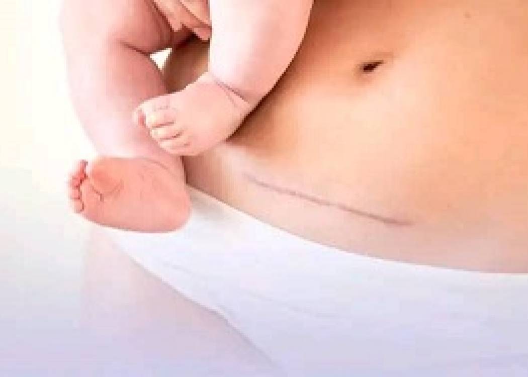 Cesárea, acto de amor (+ Fotos, Post y Audio)