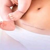 Cesárea, acto de amor (+ Fotos, Post y Audio)