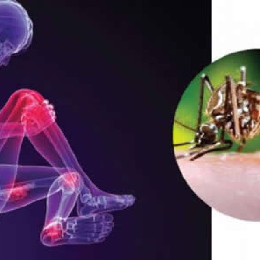 Ofrecen en Nuevitas atención especializada a pacientes con secuelas del chikungunya